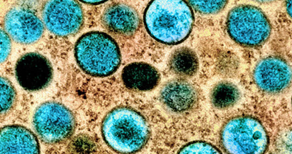 The mpox virus under a microscope