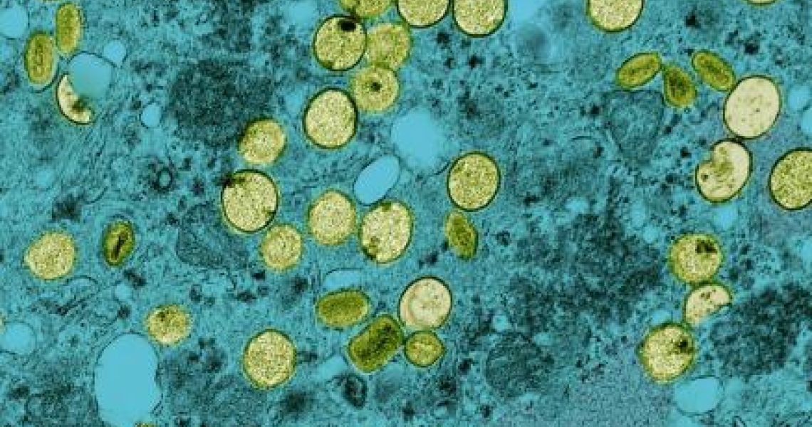 mpox virus particles from NIAID Integrated Research Facility (credit: NIAID)