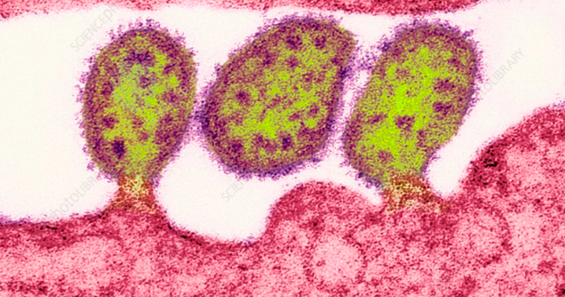 Lassa Virus under a microscope