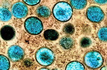 The mpox virus under a microscope