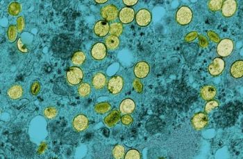 mpox virus particles from NIAID Integrated Research Facility (credit: NIAID)